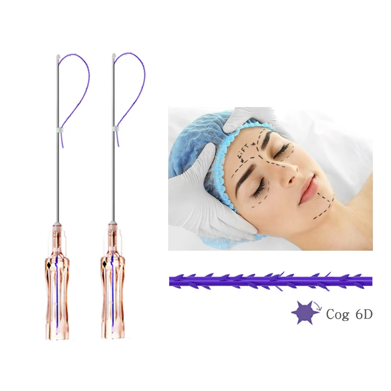 Rosca de engrenagem 6D