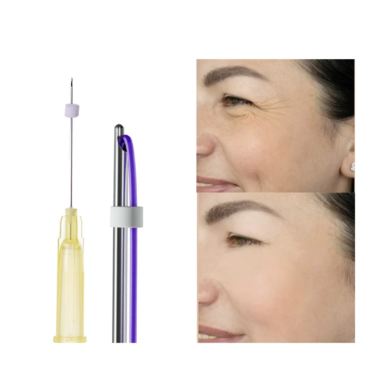 Fio ocular