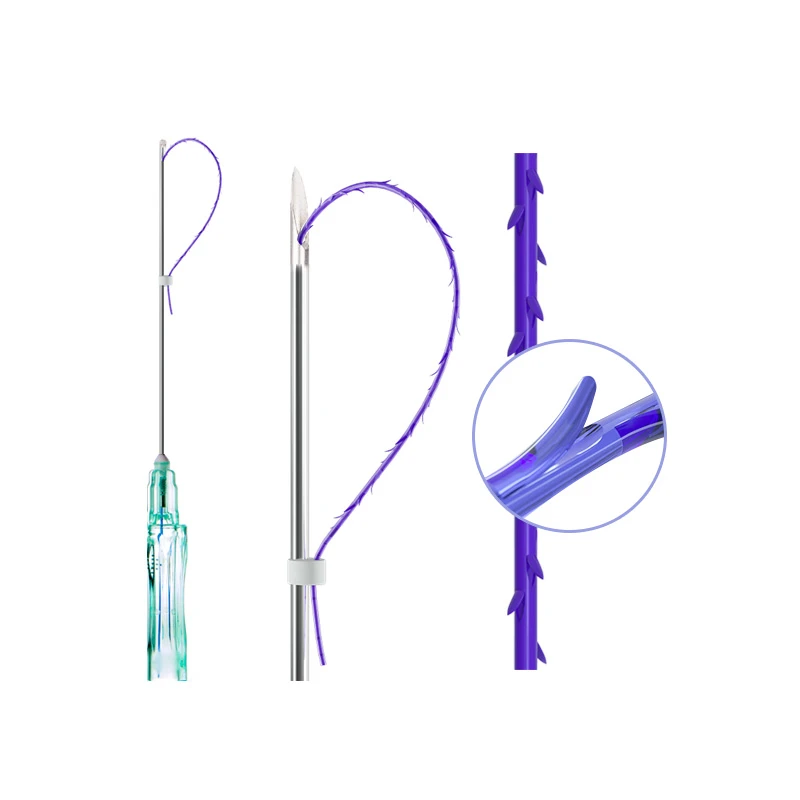 Rosca 3D de engrenagem