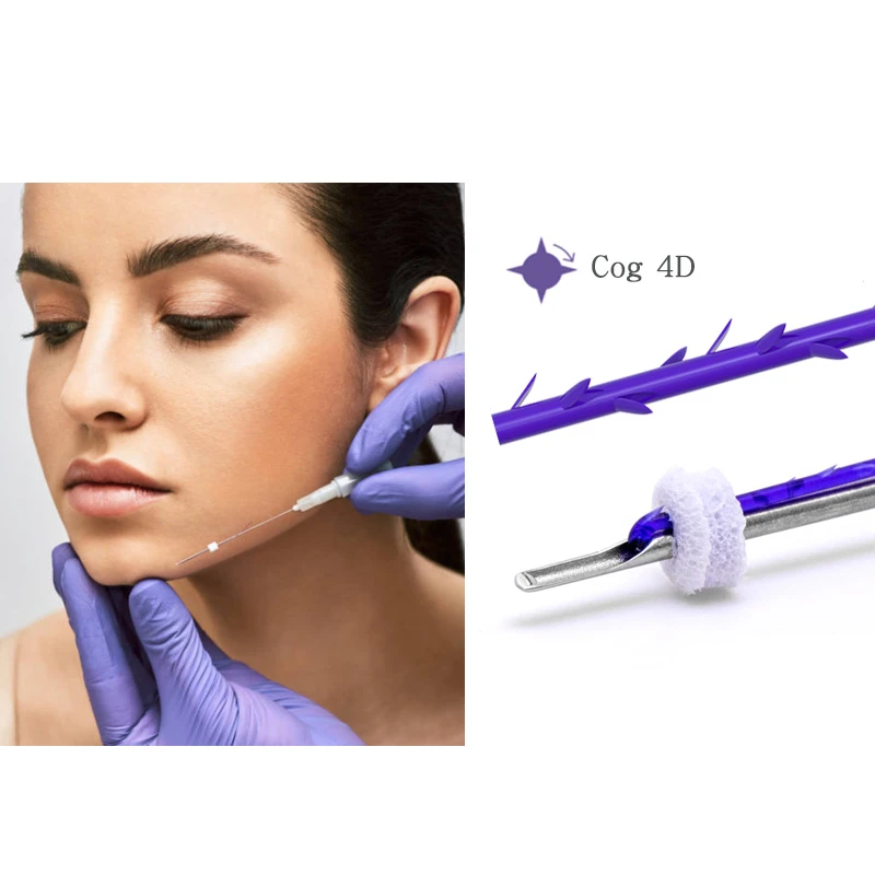 Elevador facial PDO Cog 4D: levantamento avan&ccedil;ado de linha para contorno do maxilar