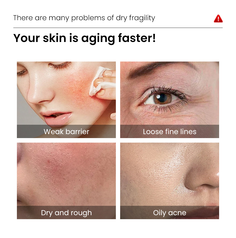 Skinbooster de ácido hialurônico 4D