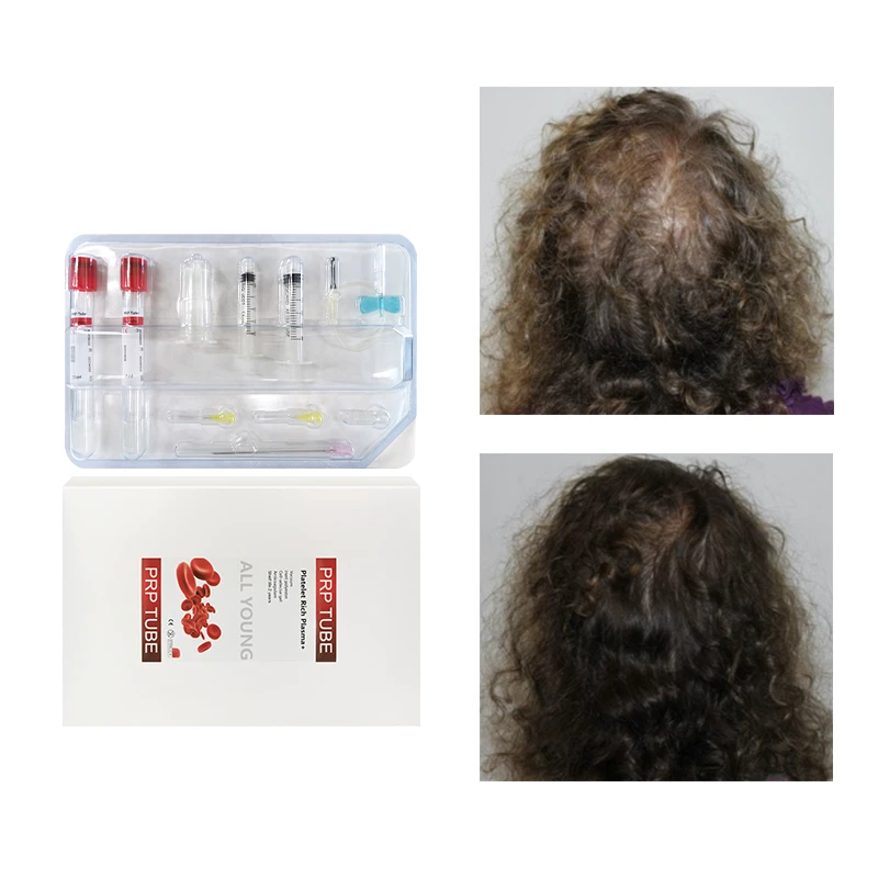 Kit de Tubo PRP de 15ML ACD GEL Fornecedor Coreano