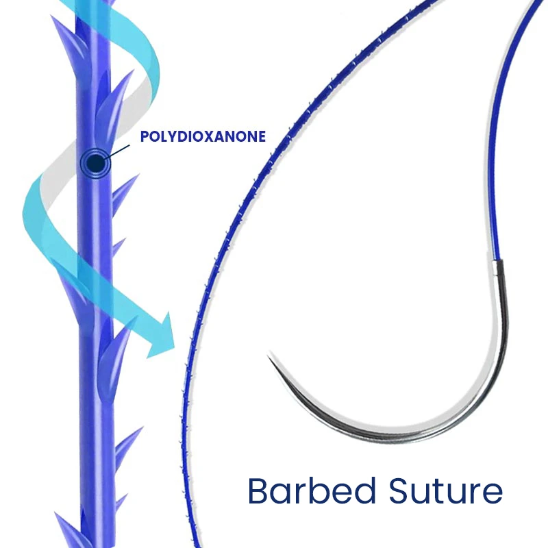 Suturas Cir&uacute;rgicas Absorv&iacute;veis