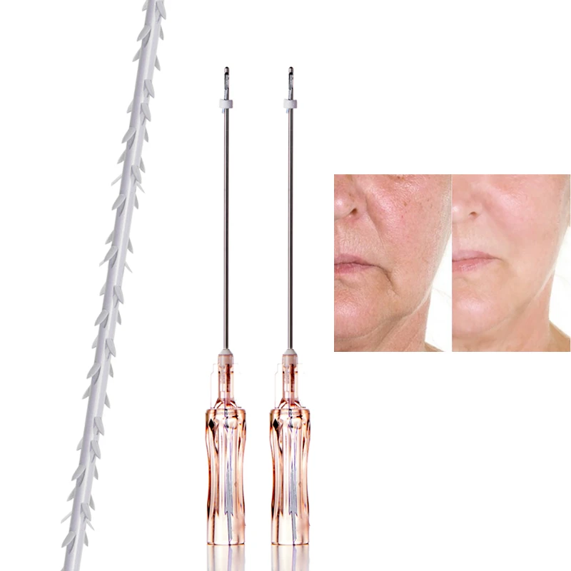 Linha farpada bidirecional PLLA COG 6D Max SMAS Lifting V-line Face Contour Premium Thread